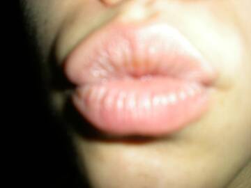 bacio